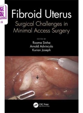 海外直订医药图书Fibroid Uterus 子宫肌瘤