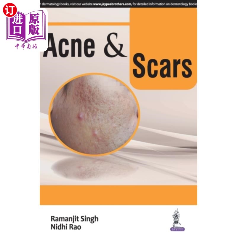 海外直订医药图书Acne & Scars 痤疮和疤痕