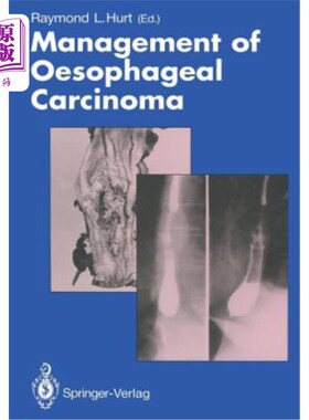 海外直订医药图书Management of Oesophageal Carcinoma 食管癌的治疗