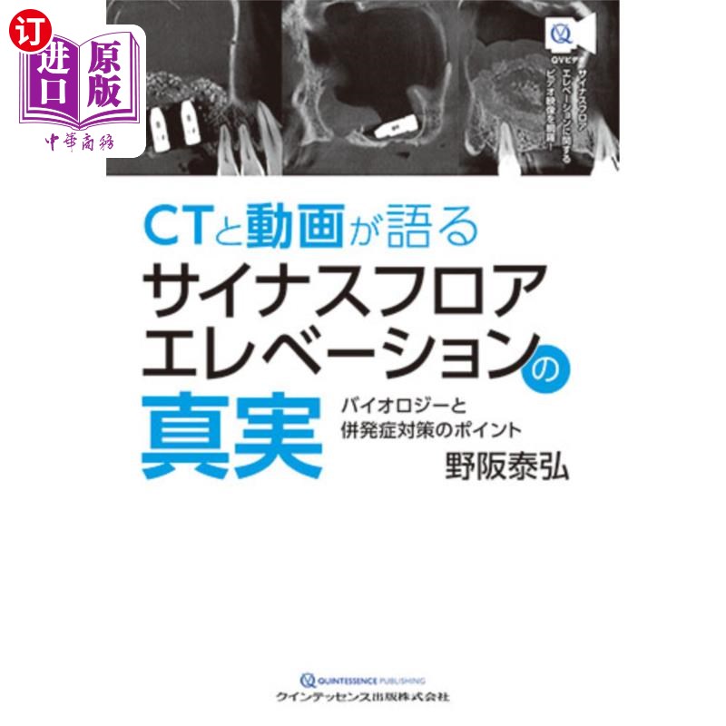海外直订日语 ＣＴと動画が語るサイナスフロアエレベーションの真実　バイオロジーと併発症対策のポイント CT和动画讲述的