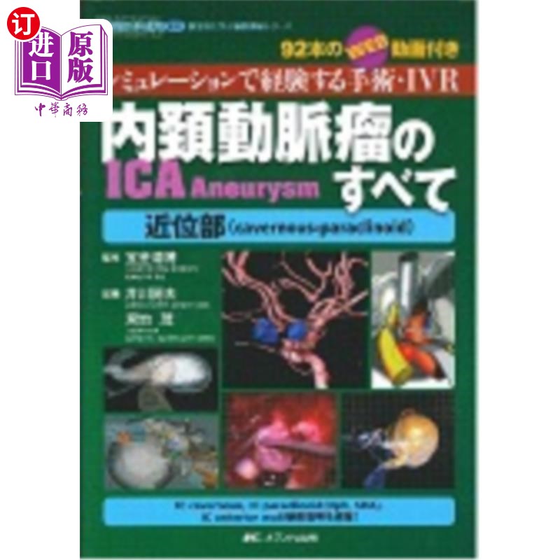 海外直订日语 内頚動脈瘤ＩＣＡ　Ａｎｅｕｒｙｓｍのすべて近位部〈ｃａｖｅｒｎｏｕｓ‐ｐａｒａｃｌｉｎｏｉｄ〉　シミュ