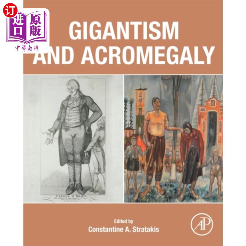 海外直订医药图书Gigantism and Acromegaly 巨人症和肢端肥大症