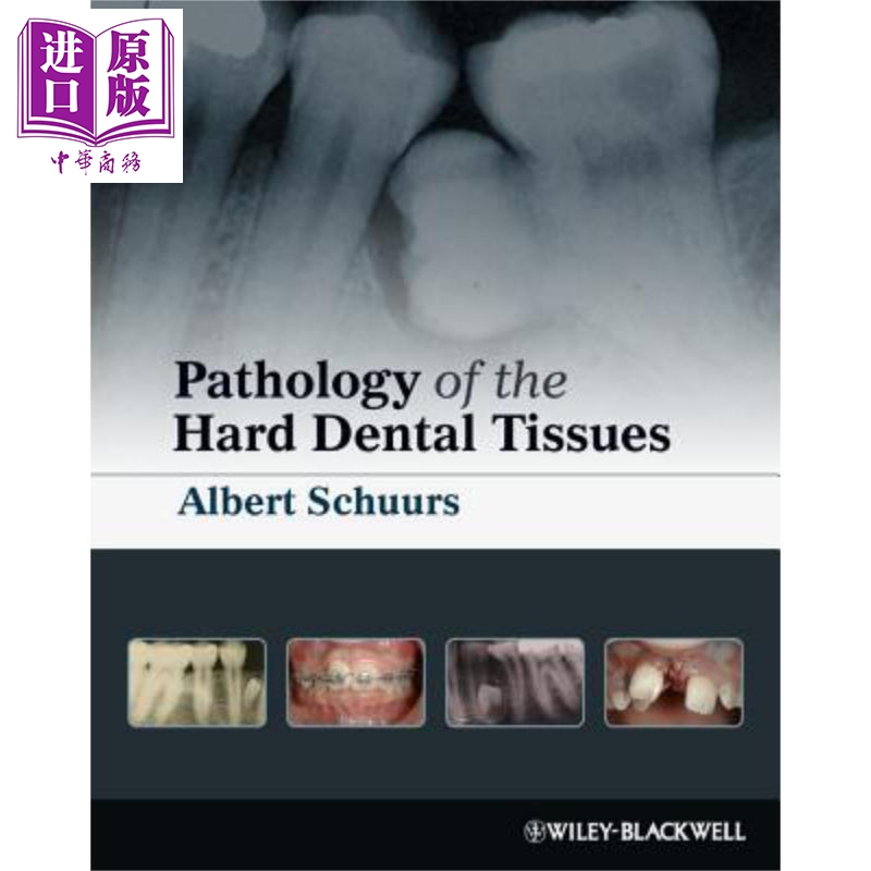 现货 牙体硬组织的病理学 Pathology Of The Hard Dental Tissues Albert Schuurs 英文原版【中商原版】wiley