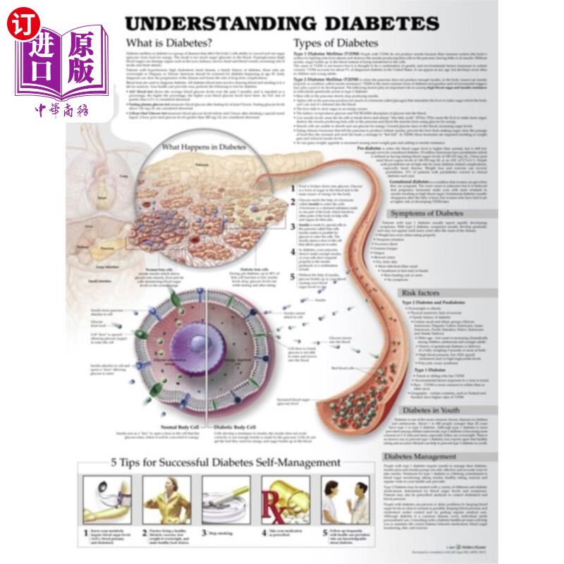 海外直订医药图书Understanding Diabetes Anatomical Chart 了解糖尿病解剖图
