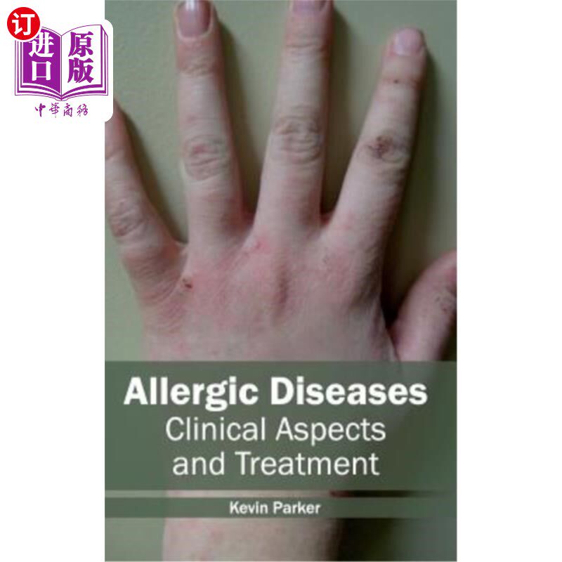 海外直订医药图书Allergic Diseases: Clinical Aspects and Treatment 过敏性疾病:临床和治疗