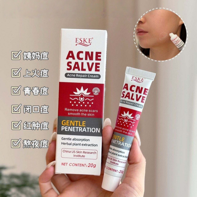 ESKE膏淡化痘坑痘印青春痘粉刺消