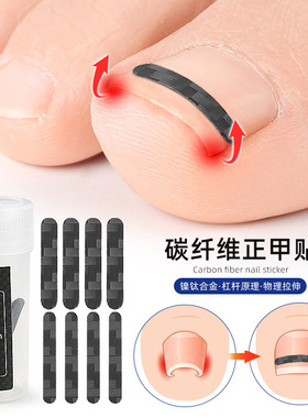 纤维正甲贴片甲沟嵌甲脚趾甲指扎肉拉正指甲器修脚趾甲工具