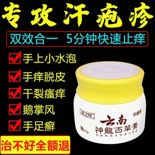 汗疱疹季节性脱皮手上起小水泡手痒干裂手气膏汗状止痒药鹅掌风膏