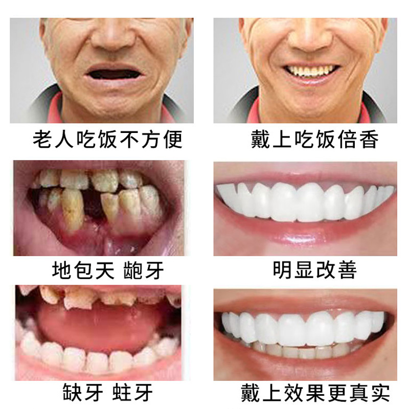 日本进口仿真牙套吃饭神器假牙套老人通用临时牙套缺牙遮丑防塞牙 美容美体仪器 其它口腔护理设备 原图主图