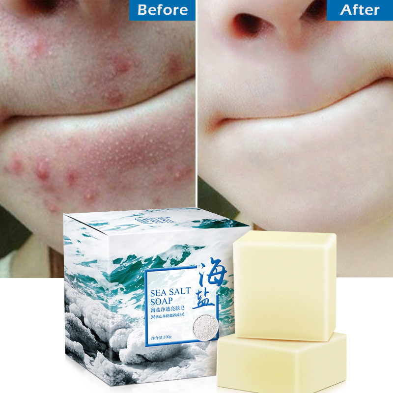 Sea Salt Soap Cleaner Removal Pimple Pores Acne海盐除螨香皂