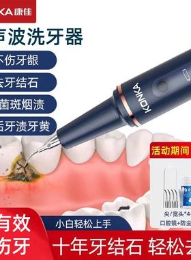 康佳超声波洗牙器洗牙齿污垢工具除牙石洁牙仪家用牙结石去除器