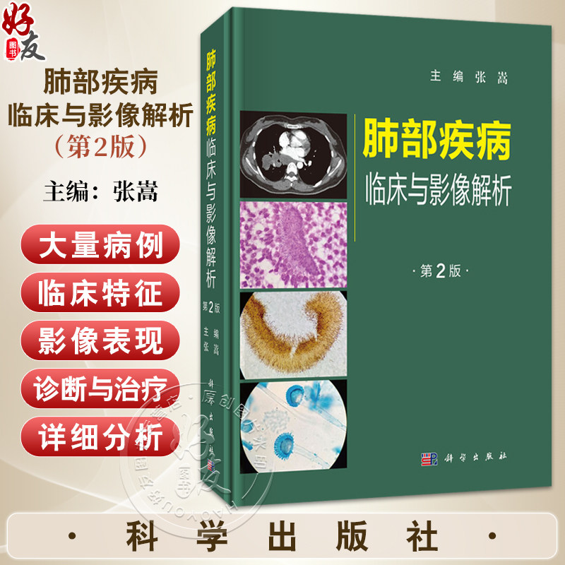 肺部疾病临床与影像解析 第2二版 张嵩 适合呼吸与危重症科 影像科医师 临床医学研究生 进修生及相关人员阅读参考 科学出版社