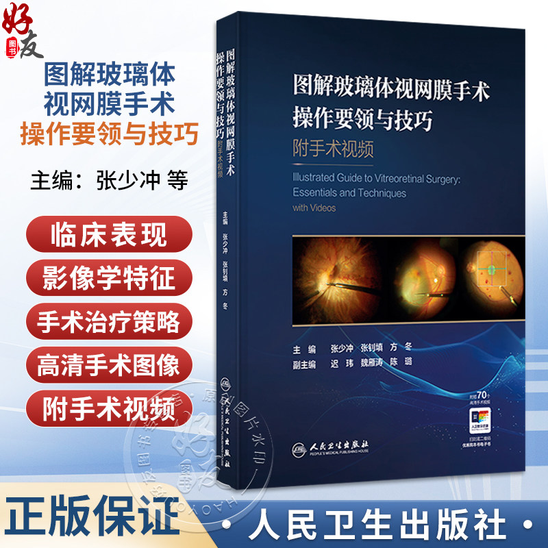 图解玻璃体视网膜手术操作要领与技巧 附手术视频 张少冲 张钊填 方冬 主编 参考书 眼科学 西医 9787117403016 人民卫生出版社