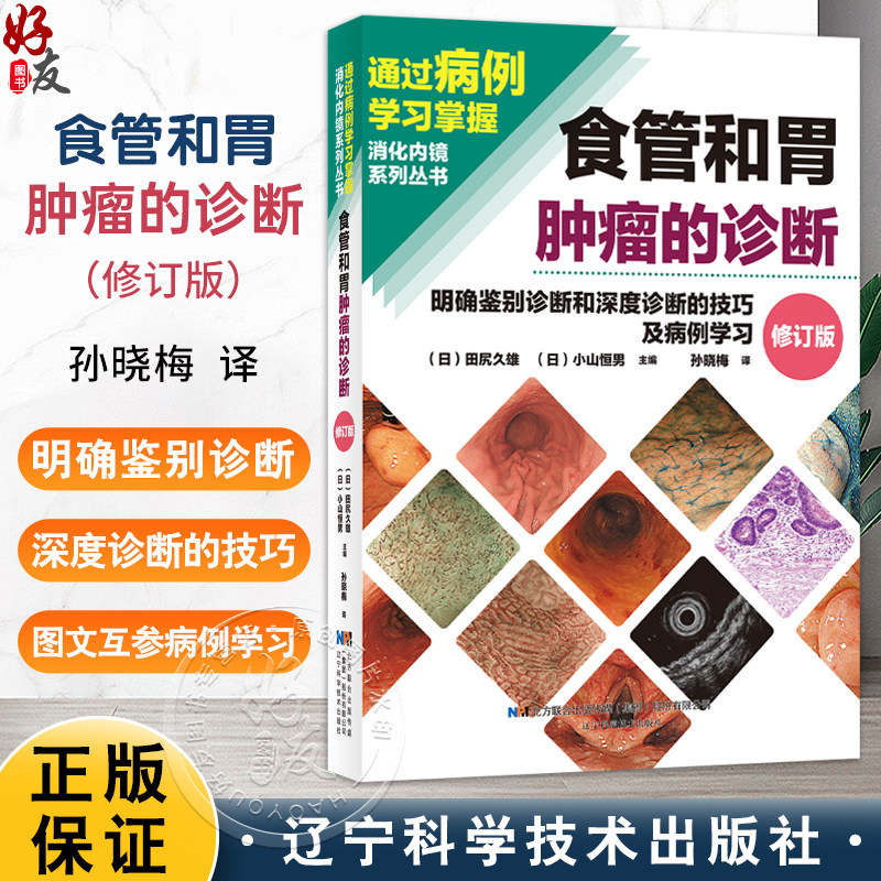 食管和胃肿瘤的诊断——明确鉴别诊断和深度诊断的技巧及病例学习（日）田尻久雄 著 内涵丰富的病例讲解 辽宁科学技术出版社
