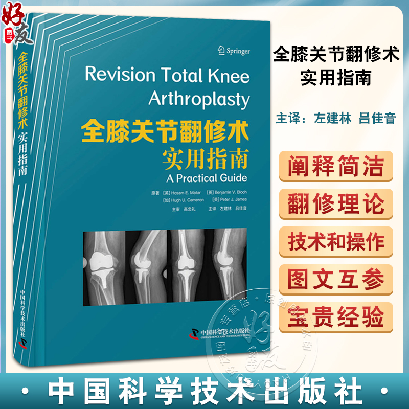 全膝关节翻修术实用指南