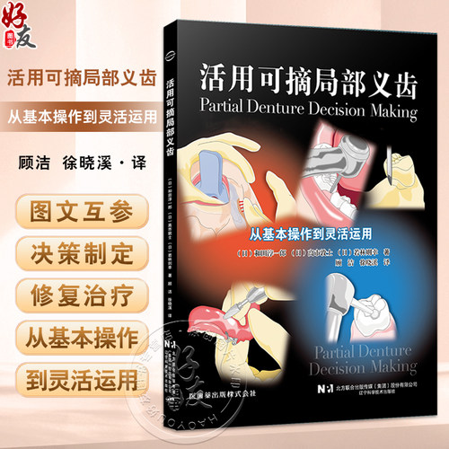 活用可摘局部义齿从基本操作