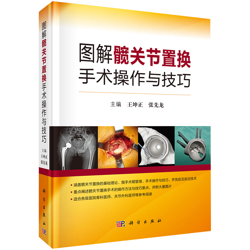 圖解髖關(guān)節(jié)置換手術(shù)操作與技巧 對(duì)關(guān)節(jié)外科醫(yī)師而言是一本難得的參考書和工具書 王坤正 張先龍主編 9787030656667 科學(xué)出版社