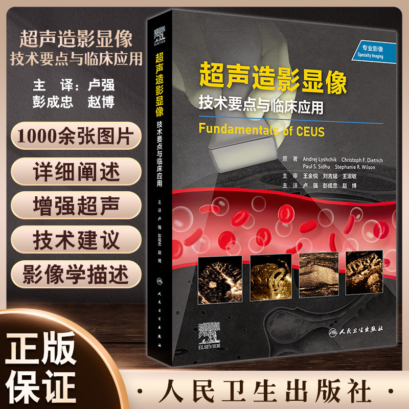 超声造影显像技术要点与临床应用