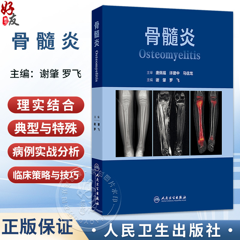 骨髓炎 谢肇 罗飞 主编 本书从基本理论（基础篇） 基本技术（技术篇） 临床应用（各论篇）三大部分依次展开叙述 人民卫生出版社