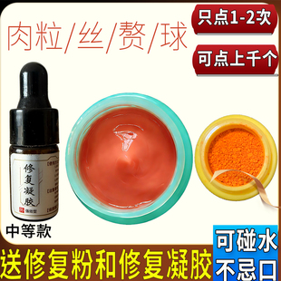 去除脖子上小肉粒皮赘丝状尤专用药膏颈部腋下肉赘祛疙瘩猴子神器