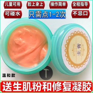 脸部点志膏修复痣无痕正品美容院去黑志专用药水点痦子神器祛黑点
