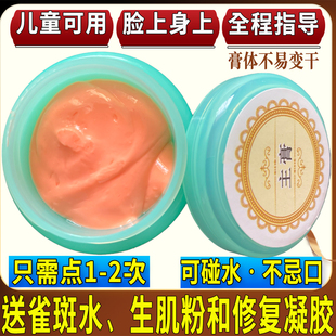 去除黑痣膏无痕祛点膏脸部雀斑不留疤点痦子黑点无痕神器专用药水