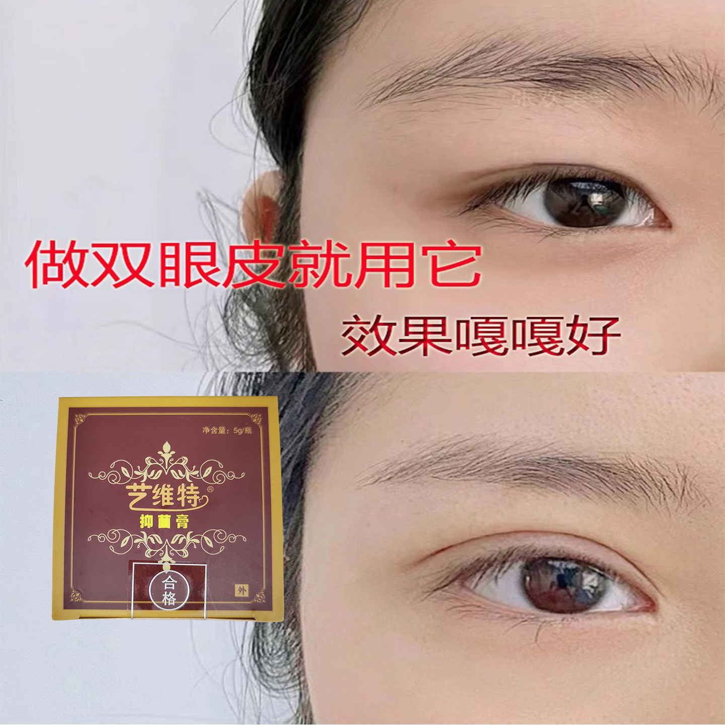 艺维特抑疤灵艺芭翎伤口护理软膏剖腹产双眼皮开眼角眉眼增生护理