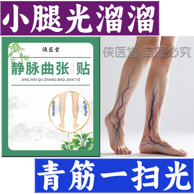 腿部青筋凸起血管鼓包红血丝皮肤发痒小腿发胀曲张腿蚯蚓腿静脉贴