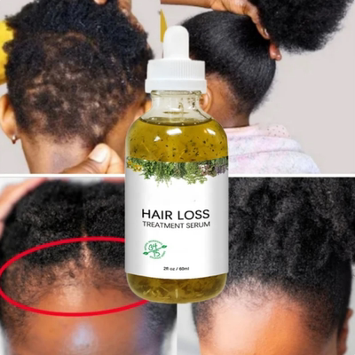 New Fast Hair Growth Serum African Crazy Regrowth