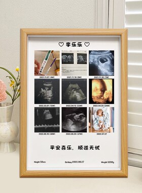 适用期B超相框定l制 四维彩超照片婴儿出生满月百日周岁礼物纪念