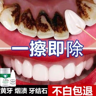 牙齿美白洁牙粉洗牙粉去黄牙烟渍亮白洗污垢除牙结石去黄清洁神器