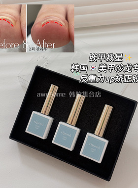 Riposo「嵌甲救星」韩国美甲店专用反重力内嵌趾甲沟矫正光疗up胶