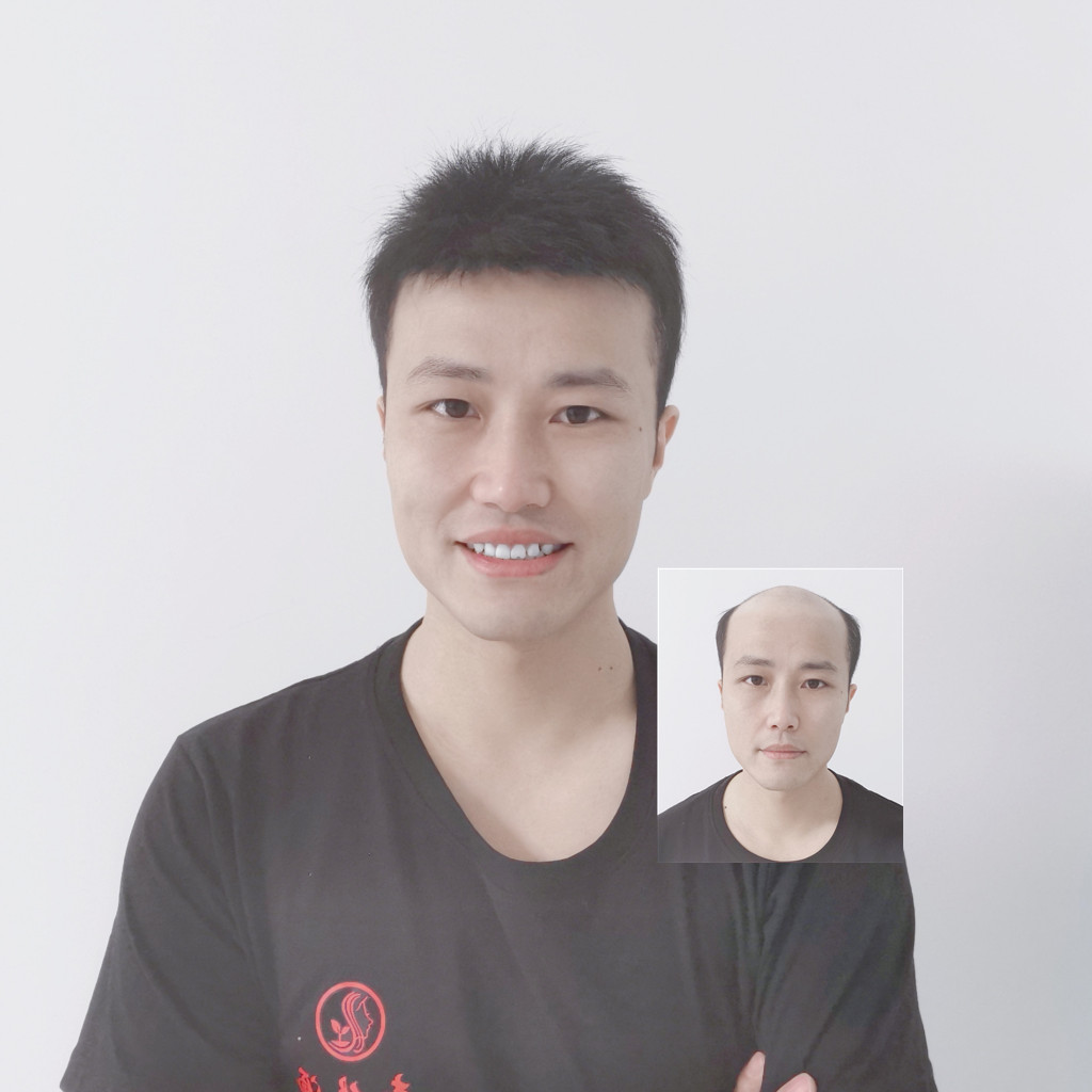 男头顶青丝源真人发丝补发片假发