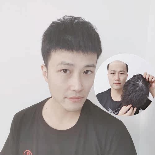 头顶织发补发片式翻盖假发神器无痕递针男隐形生物头皮自然短发 - 封面