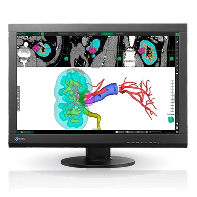 艺卓EIZORadiForce液晶显示器