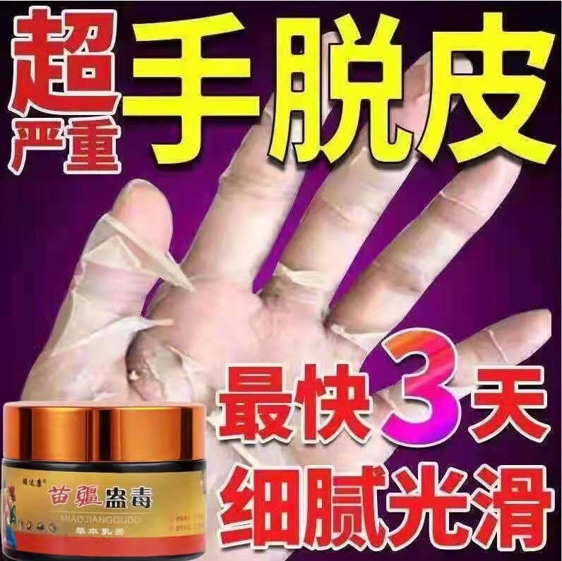 手足藓膏脱皮药膏真菌感染汗疱疹动物保健品