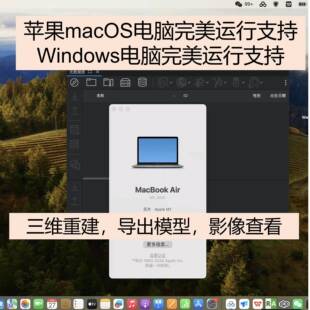 三维重建软件3D模型DICOM医学影像苹果macos主动脉心内科心脏查看