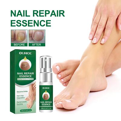 OUHOE Toenail Care Essence - Treatment for Yellowing, Thicke