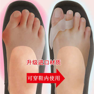 拇指外翻矫正器纠正大脚骨脚趾变形重叠分离器可穿鞋硅胶支具日用