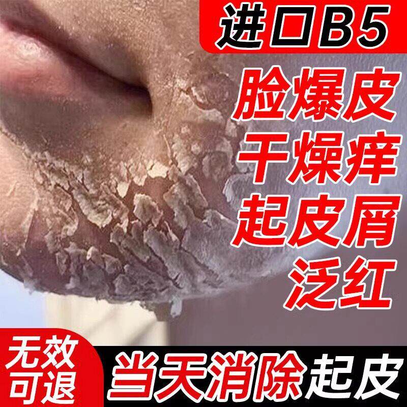 脸干 干燥起皮肤脱皮爆皮b5滋润秋冬季屏障修护正品修覆面霜保湿