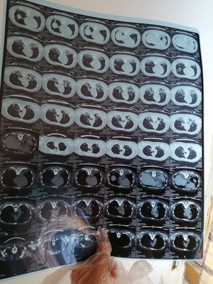 雷人评测:鱼跃制氧机真实使用感受,不想被骗看下这里