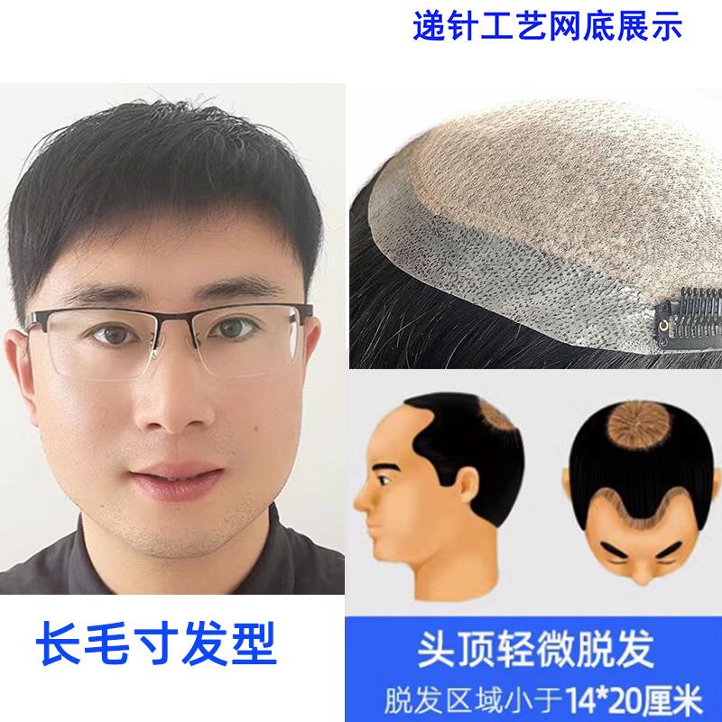 正品假发发男短发士头顶真发刘海织发补发块脱前额手织自男片然补