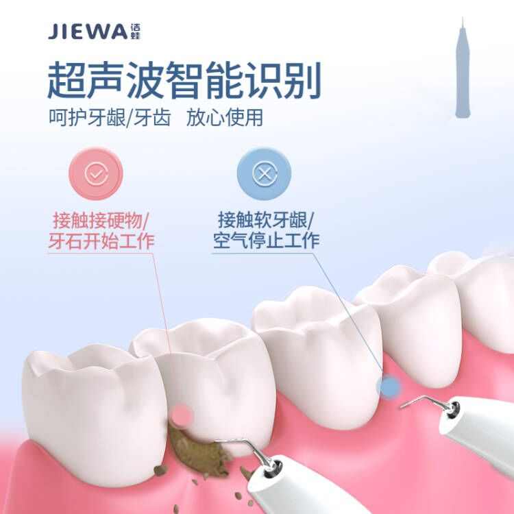 超声波洗牙器除牙石冲牙洁牙仪清洁神器洗牙齿污垢去除牙垢牙结石