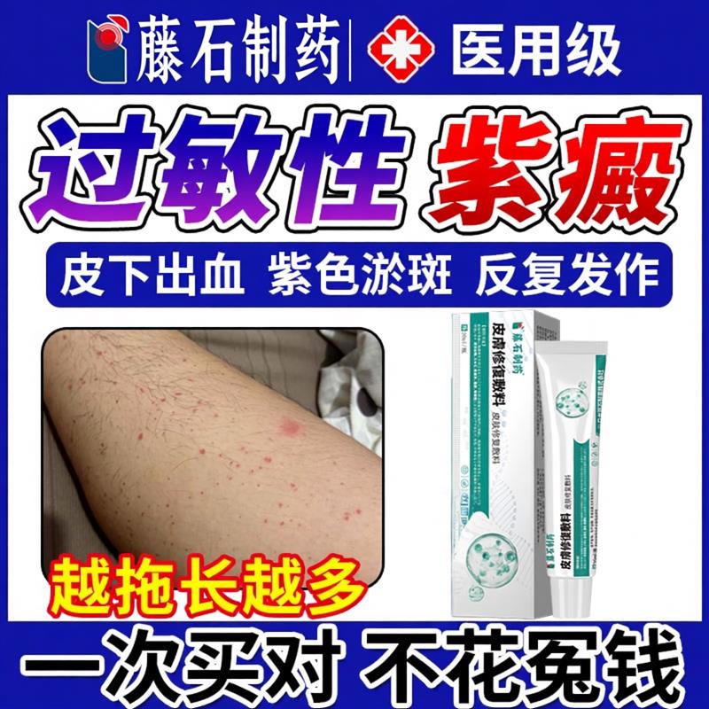 过敏性紫癜出专用膏色素特皮下血效红点瘀皮炎血管炎CA医星熊旗舰
