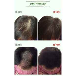 高档增纤维男头发发纤维粉美发假发女浓密发粉补发顶遮盖丰稀疏