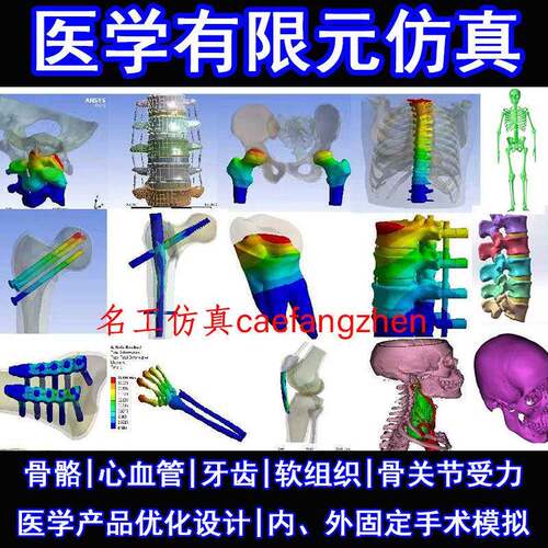 医学有限元颈腰椎脊柱口腔牙骨科生物力学彷真分析ct重建模型代做
