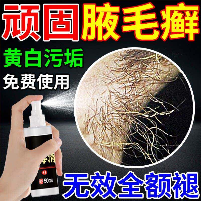 腋毛癣白色附着物胳肢窝下藓出汗瘙痒非清洁洗污垢非去异味非药膏