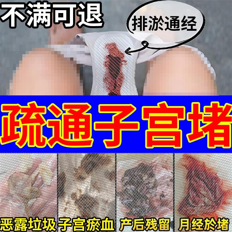 子宫排毒堵贴宫寒淤堵药子宫淤疏通贴卵巢保养暖宫调经贴月经量少