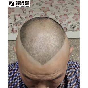 郭德纲成人理发模具同款头型大人发型郭德纲桃心短发剃头辅助神器