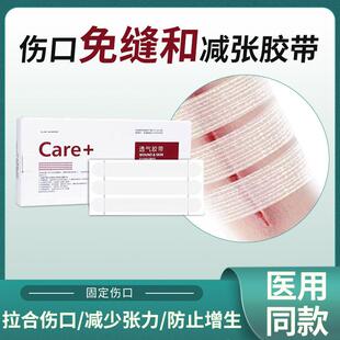 伤口免缝合贴减张贴减张器剖腹产疤痕贴医用术后儿童张力贴闭合器